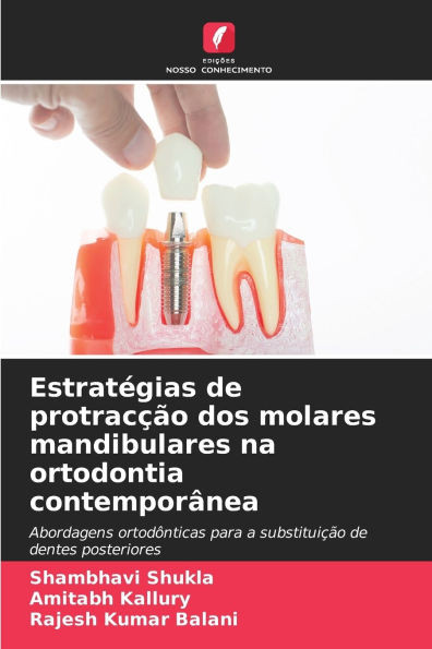 EstratÃ©gias de protracÃ§Ã£o dos molares mandibulares na ortodontia contemporÃ¢nea