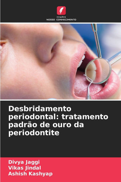 Desbridamento periodontal: tratamento padrão de ouro da periodontite