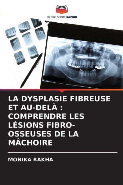 La Dysplasie Fibreuse Et Au-DelÃ : Comprendre Les LÃ©sions Fibro-Osseuses de la MÃ¢choire