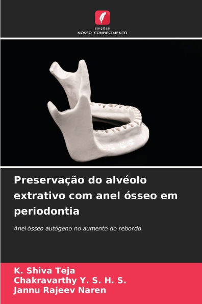 Preservação do alvéolo extrativo com anel ósseo em periodontia