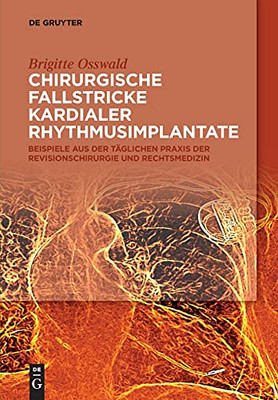 Chirurgische Fallstricke Kardialer Rhythmusimplantate: Beispiele Aus Der T?glichen Praxis Der Revisionschirurgie Und Rechtsmedizin (German Edition)