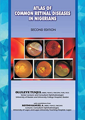 The Atlas Of Retinal Diseases In Nigerians