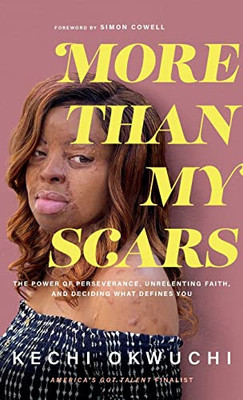 More Than My Scars - Hardcover