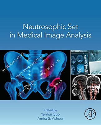 Neutrosophic Set in Medical Image Analysis