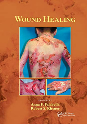 Wound Healing (Basic and Clinical Dermatology)