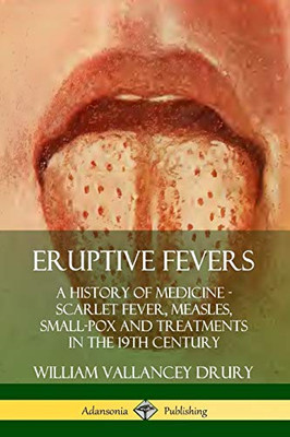 Eruptive Fevers: A History of Medicine - Scarlet Fever, Measles, Small-Pox and Treatments in the 19th Century
