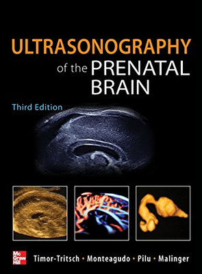 Ultrasonography of the Prenatal Brain, Third Edition