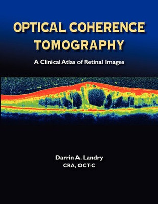 Optical Coherence Tomography: A Clinical Atlas of Retinal Images
