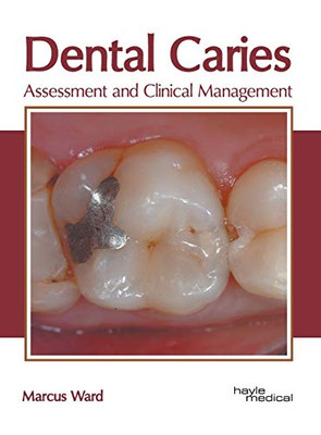 Dental Caries: Assessment And Clinical Management