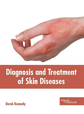 Diagnosis And Treatment Of Skin Diseases
