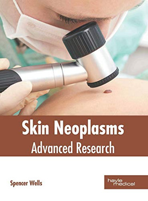 Skin Neoplasms: Advanced Research