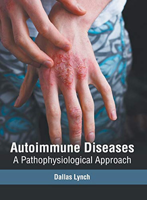 Autoimmune Diseases: A Pathophysiological Approach