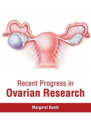 Recent Progress In Ovarian Research