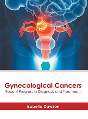 Gynecological Cancers: Recent Progress In Diagnosis And Treatment