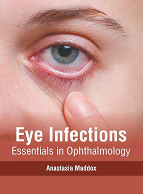 Eye Infections: Essentials In Ophthalmology