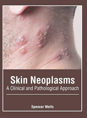 Skin Neoplasms: A Clinical And Pathological Approach