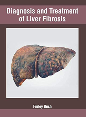 Diagnosis And Treatment Of Liver Fibrosis