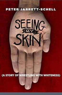 Seeing My Skin: A Story Of Wrestling With Whiteness