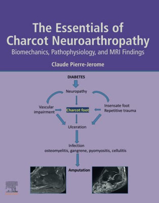 The Essentials Of Charcot Neuroarthropathy: Biomechanics, Pathophysiology, And Mri Findings
