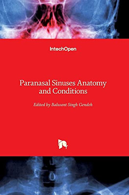 Paranasal Sinuses Anatomy And Conditions