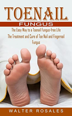 Toenail Fungus: The Easy Way To A Toenail Fungus-Free Life (The Treatment And Cure Of Toe Nail And Fingernail Fungus)