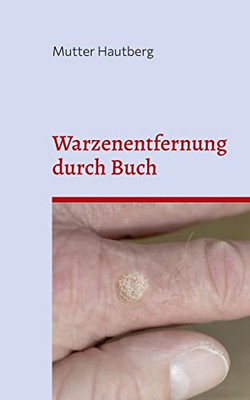 Warzenentfernung durch Buch: Heilung durch gespeicherte uralte BesprechEnergie (German Edition)