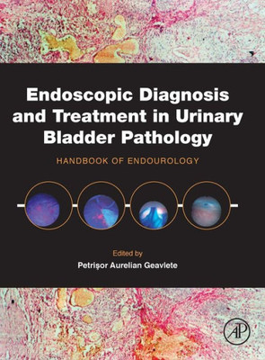 Endoscopic Diagnosis And Treatment In Urinary Bladder Pathology: Handbook Of Endourology