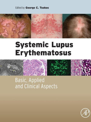 Systemic Lupus Erythematosus: Basic, Applied And Clinical Aspects