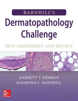 Barnhill'S Dermatopathology Challenge: Self-Assessment & Review