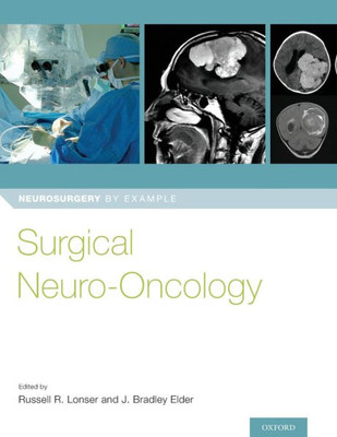 Surgical Neuro-Oncology (Neurosurgery By Example)