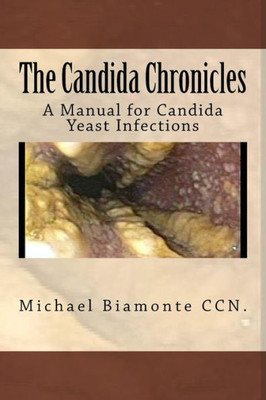 The Candida Chronicles: A Manual For Candida Yeast Infections