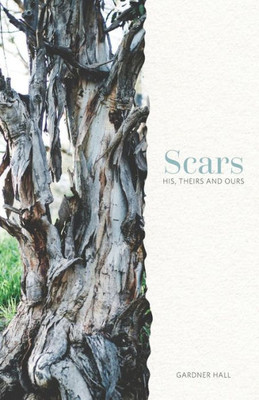 Scars: His, Theirs And Ours