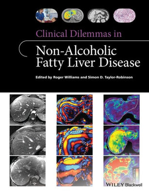 Clinical Dilemmas in Non-Alcoholic Fatty Liver Disease (Clinical Dilemmas (UK))