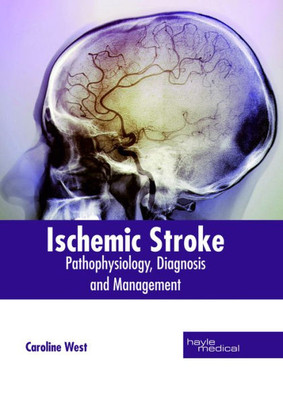 Ischemic Stroke: Pathophysiology, Diagnosis And Management