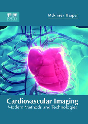 Cardiovascular Imaging: Modern Methods And Technologies