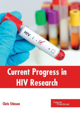 Current Progress In Hiv Research