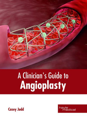 A Clinician'S Guide To Angioplasty