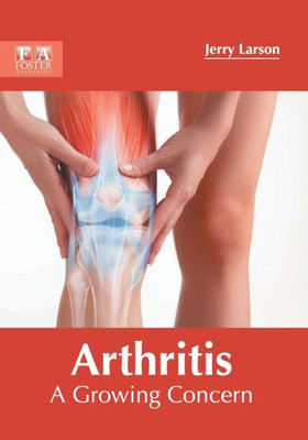 Arthritis: A Growing Concern