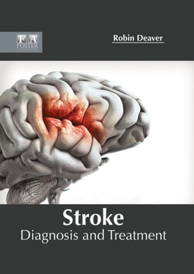Stroke: Diagnosis And Treatment
