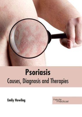 Psoriasis: Causes, Diagnosis And Therapies