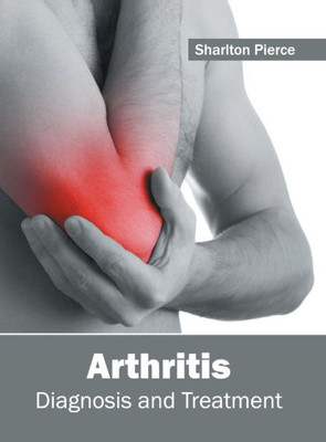 Arthritis: Diagnosis And Treatment