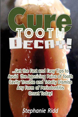 Cure Tooth Decay!: Get The Fast And Easy Tips To Avoid The Agonizing Pains Of Tooth Cavity Trouble And Totally Dismiss Any Form Of Periodontitis Onset Today!