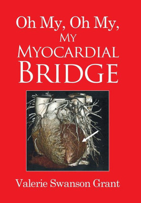 Oh My, Oh My, My Myocardial Bridge