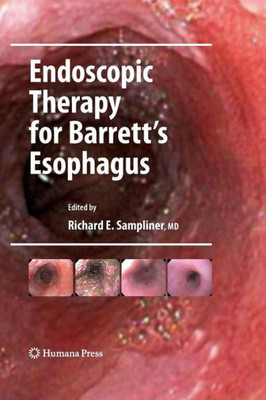 Endoscopic Therapy For Barrett'S Esophagus (Clinical Gastroenterology)