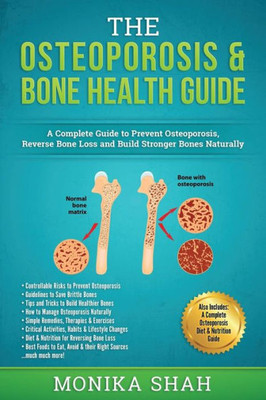 Osteoporosis: The Osteoporosis & Bone Health Guide: A Complete Guide To Prevent Osteoporosis, Reverse Bone Loss And Build Stronger Bones Naturally