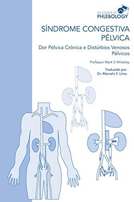 SÍNDROME CONGESTIVA PÉLVICA Dor Pélvica Crônica e Distúrbios Venosos Pélvicos (Portuguese Edition)