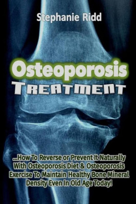 Osteoporosis Treatment: How To Reverse Or Prevent It Naturally With Osteoporosis Diet And Osteoporosis Exercise To Maintain Healthy Bone Mineral Density Even In Old Age Today!