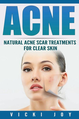 Acne: Natural Acne Scar Treatments For Clear Skin