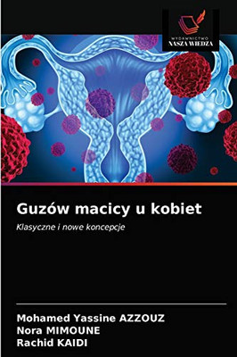Guzów macicy u kobiet (Polish Edition)