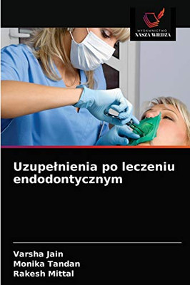 Uzupelnienia po leczeniu endodontycznym (Polish Edition)